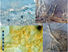 Fig. 3 Microscopic views. top left: section through surface. Bottom left: subcutis. Right: terminal elements.