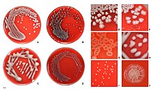 E.coli colonies on agar.
