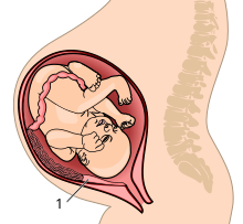 The placenta attaches to the uterine wall, and the umbilical cord connects it to the fetus. Placenta system.svg