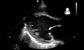 File:UOTW 7 - Ultrasound of the Week 1.webm