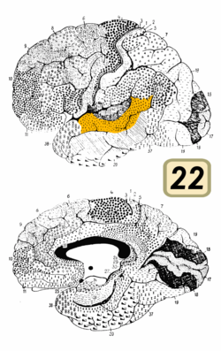 Brodmann Cytoarchitectonics 22.png