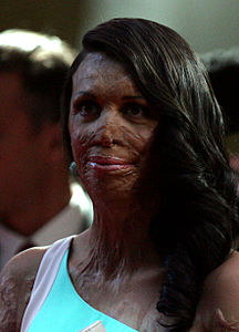 Turia Pitt