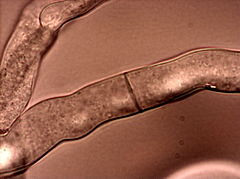 Description de l'image Neurospora crassahyphae.jpg.