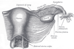 Miniatura para Ligamento suspensorio del ovario