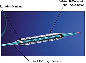 Стент Taxus FDA.jpg