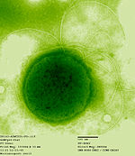 Thermococcus gammatolerans, na radioaktivno sevanje odporna arheja