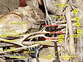 Brachial plexus and subclavian artery