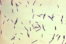 Fotomicrografia de Clostridium perfringens