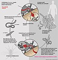 Миниатюра для Файл:Life Cycle of Onchocerca volvulus PLoS Medicine nl.jpg