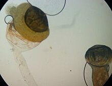 Pilobolus sporangium Pilobolus2.jpg