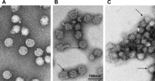 Tick-Borne Encephalitis Virus.png