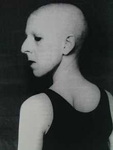 Photographie en noir et blanc d'une personne chauve de trois-quart dos portant un débardeur