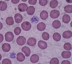 Blood Platelets Pictures