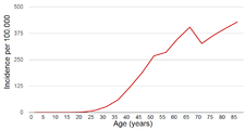 Breast cancer incidence by age
