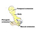 Cheek reduction: Anatomic illustration of the fat pads of the mouth (buccal fat pads).