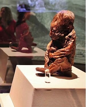 Die Detmolder Kindermumie im Lippischen Landesmuseum in Detmold: Auffällig ist die abnorme Schädelform