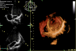 GIF-animation showing a moving echocardiogram;...
