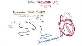 Файл:Atrial fibrillation video.webm