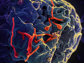 Ebola Virus (2).jpg