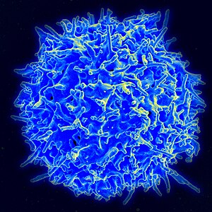 T-celleukemie / lymfoom bij volwassenen