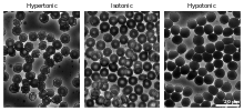 Micrographs of the effects of osmotic pressure Human Erythrocytes OsmoticPressure PhaseContrast Plain.svg