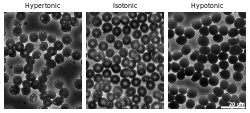 Micrographs of osmotic pressure on red blood cells Human Erythrocytes OsmoticPressure PhaseContrast Plain.svg