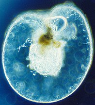 Noctiluca scintillans, a bioluminescence dinoflagellate