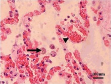 Toxoplasma gondii in the lung of a giant panda. Arrow: macrophages containing tachyzoites. Parasite150075-fig1 Toxoplasma gondii in Giant panda.tif