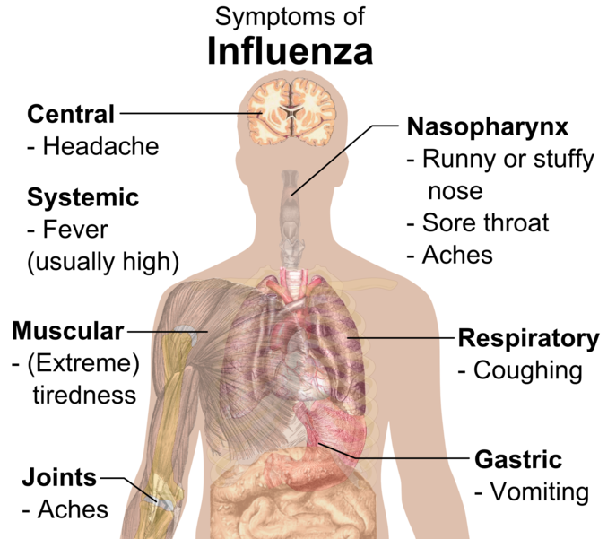 File:Symptoms of influenza.png