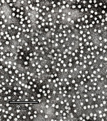 Microscopie électronique en transmission de l'antigène HBsAg du virus de l'hépatite B.