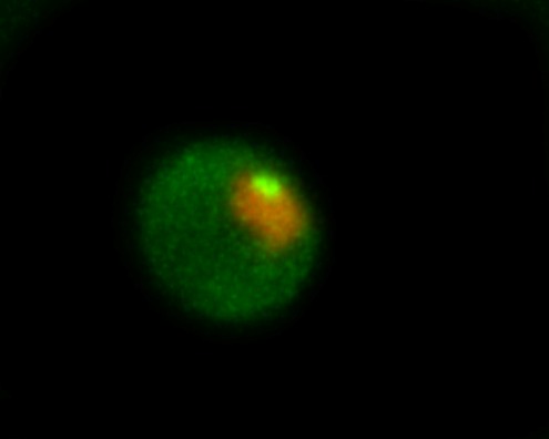 קובץ:JUNQ (green) tethered to the nucleus (orange).tif