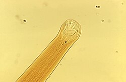 Ancylostoma braziliense mouth parts CDC PHIL ID1375.jpg