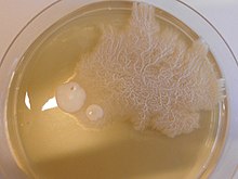 Candida albicans growing as yeast cells and filamentous (hypha) cells Candida albicans growing as yeast cells and filamentous (hypha) cells.jpg