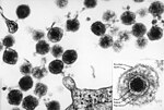 Miniatura para Human herpesvirus 6