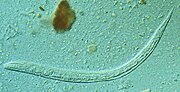 Vignette pour Strongyloides stercoralis