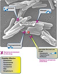 Extensively Drug-Resistant Tuberculosis (XDR TB) Diminishing Options for Treatment (5102295715).jpg