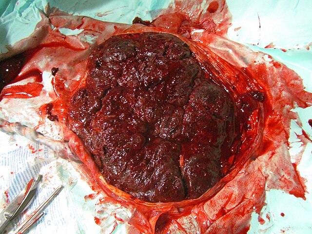 placenta