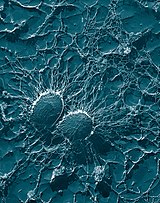 Staphylococcus aureus, magnified 50000x