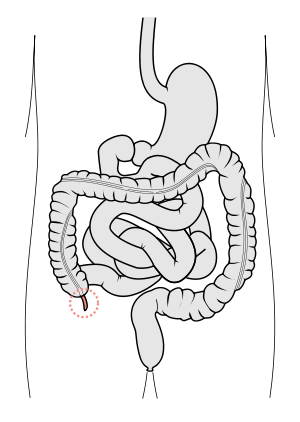 Scheme of digestive tract, with vermiform appe...