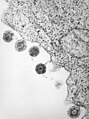 Herpèsvirus humain type 6 après libération de la membrane cellulaire.