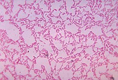 bacteroides ureolyticus