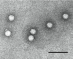 EM-Aufnahme von Virionen von PEMV-1