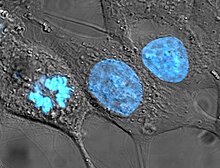 Human cancer cells, specifically HeLa cells, with DNA stained blue. The central and rightmost cell are in interphase, so their DNA is diffuse and the entire nuclei are labelled. The cell on the left is going through mitosis and its chromosomes have condensed. HeLa cells stained with Hoechst 33258.jpg