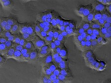 Cultuur van rathepatoomcellen, met DNA in de kernen Hoechst-gekleurd