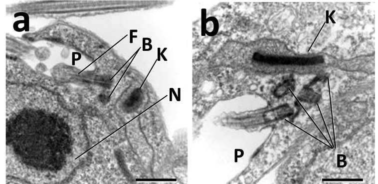 ファイル:Kinetoplast of Trypanosoma brucei.tif
