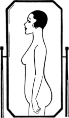 Lordosis