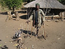 A land mine victim in Mozambique Land mine victim 2 (4364914733).jpg
