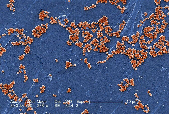 Methicillin-resistant Staphylococcus aureus 10048