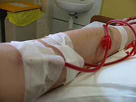 http://upload.wikimedia.org/wikipedia/commons/thumb/6/6e/Plugged_into_dialysis.jpg/275px-Plugged_into_dialysis.jpg