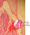 Tessuto connettivo fibroso